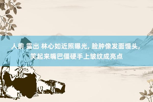人前 露出 林心如近照曝光, 脸肿像发面馒头, 笑起来嘴巴僵